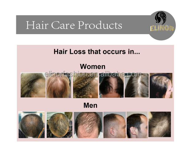 Top Quality Effective FEG fast hair growth oil