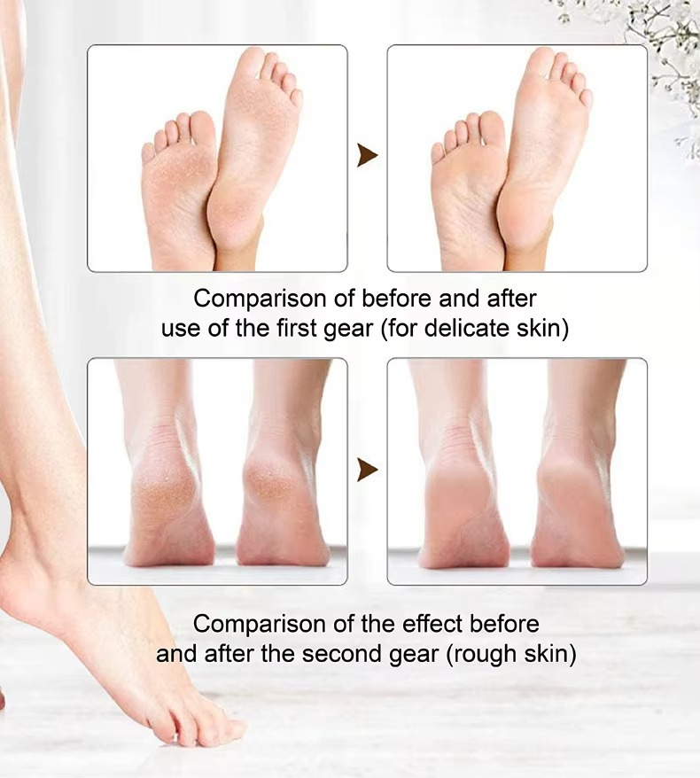 Rechargeable Electronic Foot Callus Remover High-Efficiency Electric Foot Grinder for Smoother Foot File
