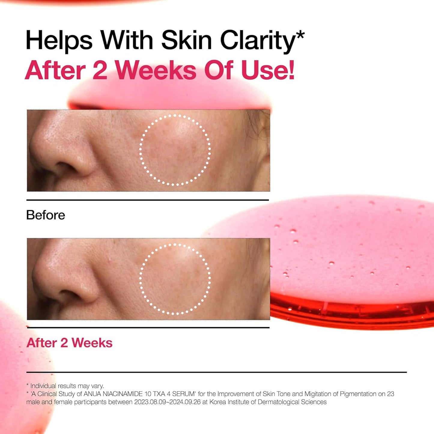 Anua 10% Niacinamide+ 4% Tranexamic Dark Spot Correcting Serum