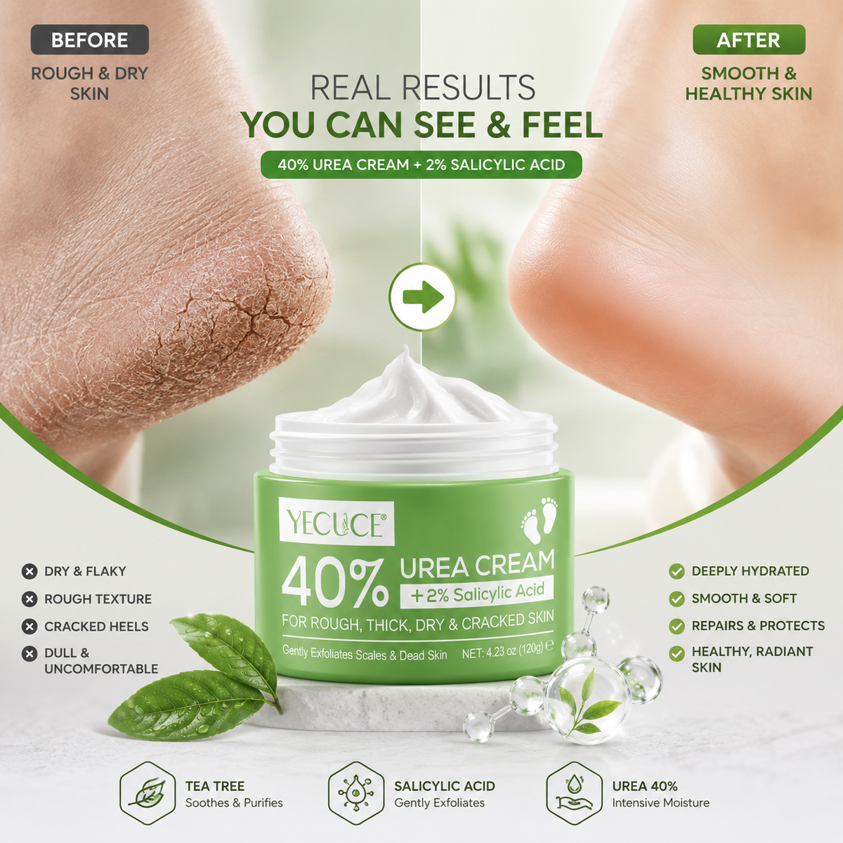 YECUCE 40% Urea Intensive Foot & Heel Repair Cream 120g