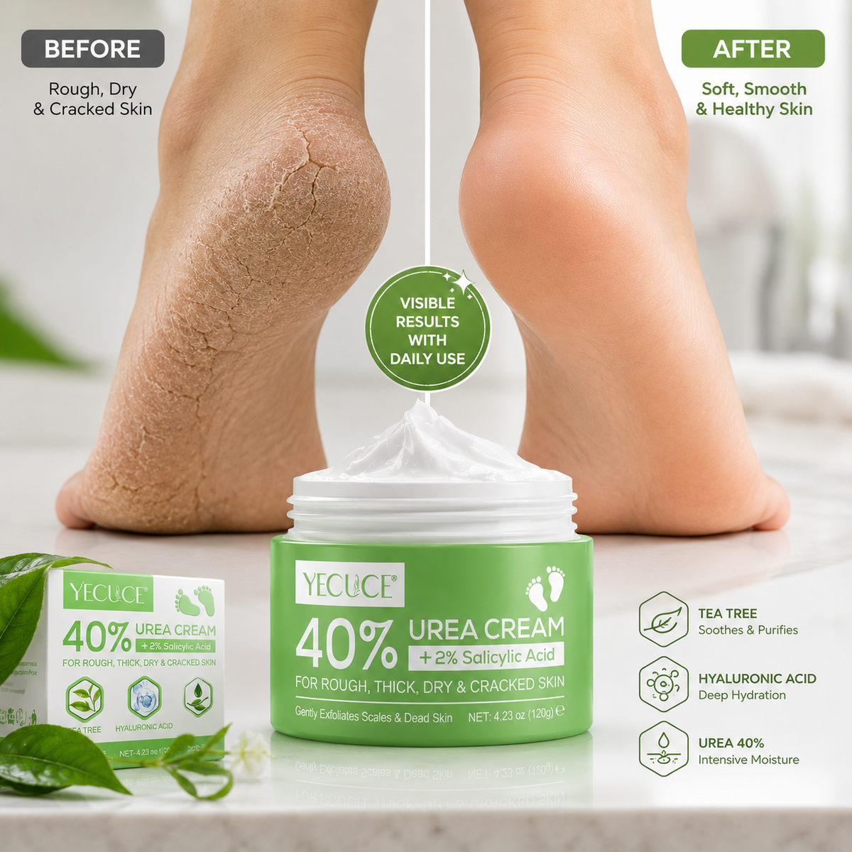 YECUCE 40% Urea Intensive Foot & Heel Repair Cream 120g