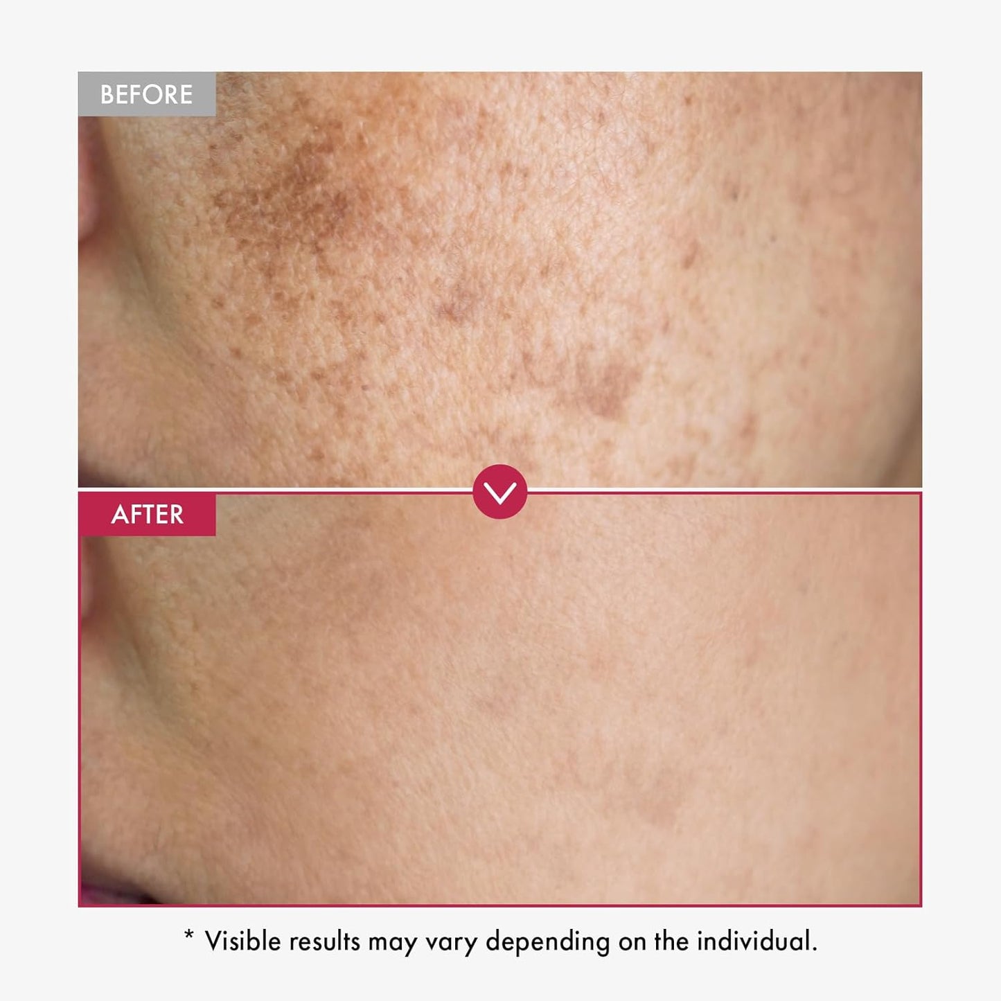 Moika 10% Niacinamide + 4% TXA Serum Anti aging Brightening Serum For Hyper-pigmentation and  Wrinkles 30ml