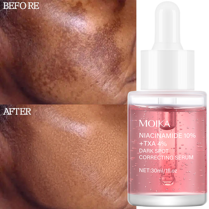 Moika 10% Niacinamide + 4% TXA Serum Anti aging Brightening Serum For Hyper-pigmentation and  Wrinkles 30ml