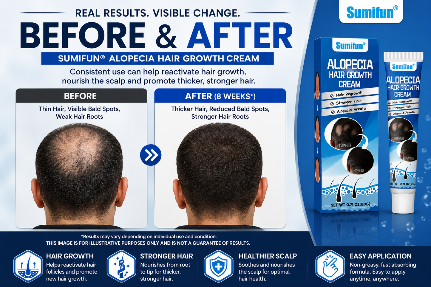 Alopecia Hair Growth Cream