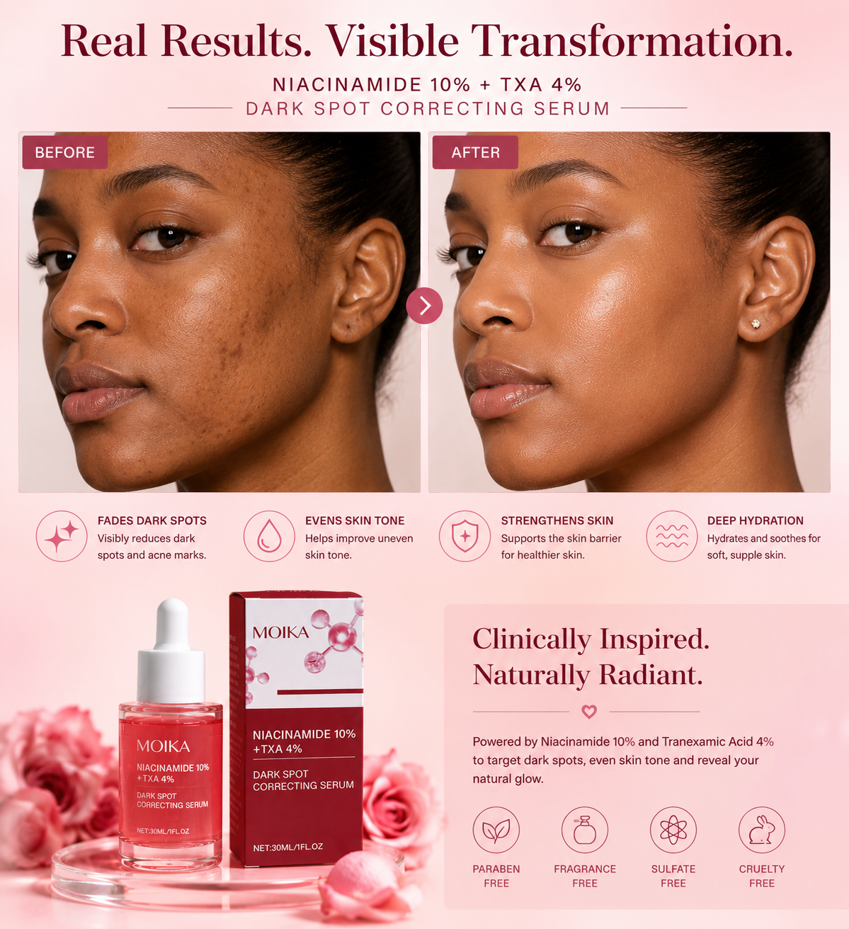 Moika 10% Niacinamide + 4% TXA Serum Anti aging Brightening Serum For Hyper-pigmentation and  Wrinkles 30ml