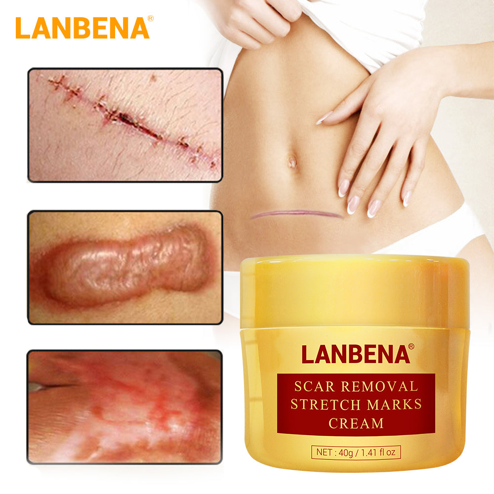 LANBENA Scar Removal Cream Acne Scars and Stretchmarks Treatment Cream